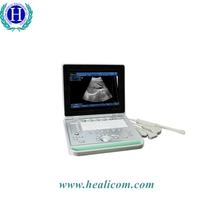 Scanner à ultrasons B pour ordinateur portable basé sur un PC sécurisé HBW-9