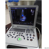 Machine de scanner à ultrasons Doppler couleur portable HUC-250 pour équipement médical