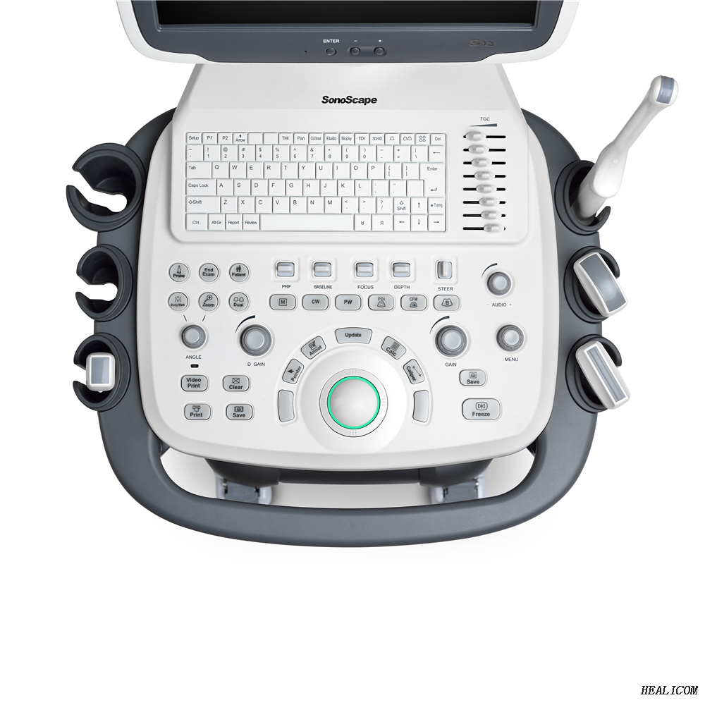 Scanner à ultrasons Doppler couleur de chariot à ultrasons entièrement numérique Sonoscape S12 de haute qualité