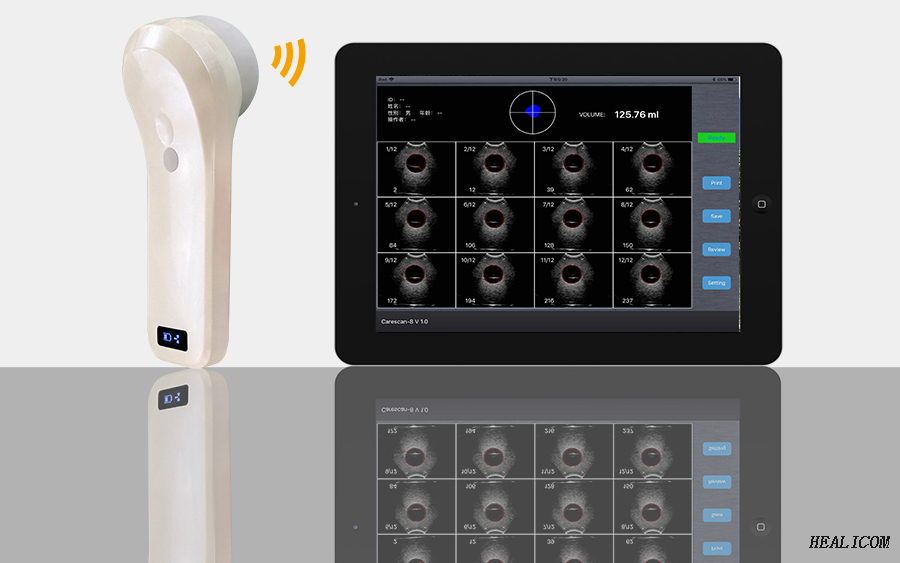 Machine à ultrasons Scanner de vessie sans fil Mini sonde à ultrasons