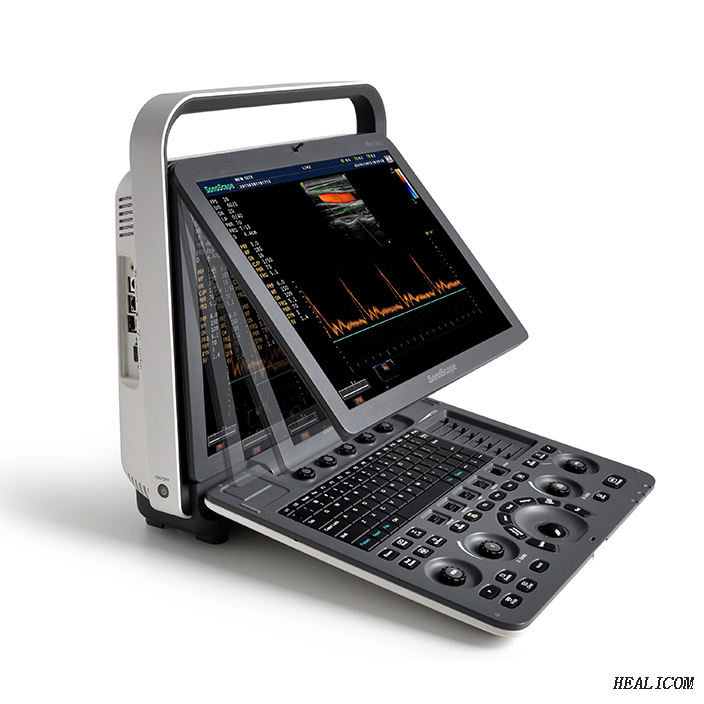 Sonoscape S8 Exp Ultrasound 3D 4D Chariot numérique à ultrasons Doppler couleur avec CE