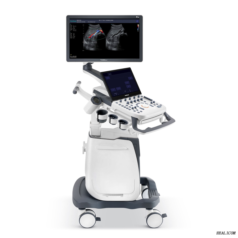 Machine à ultrasons Sonoscape P25 2D/3D/4D de haute qualité/échographe doppler couleur