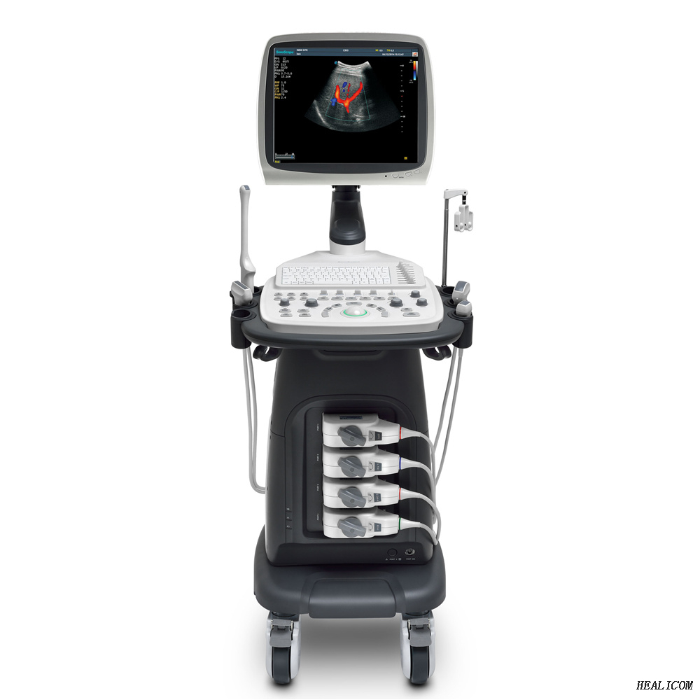 Scanner à ultrasons Doppler couleur de chariot à ultrasons entièrement numérique Sonoscape S12 de haute qualité