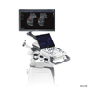 Machine à ultrasons Sonoscape P25 2D/3D/4D de haute qualité/échographe doppler couleur