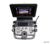 Machine à ultrasons 4D Huc-800 pour la thérapie d'image numérique médicale usg sur la santé et la médecine