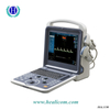 Scanner à ultrasons Doppler couleur entièrement numérique portable HUC-260 de haute qualité