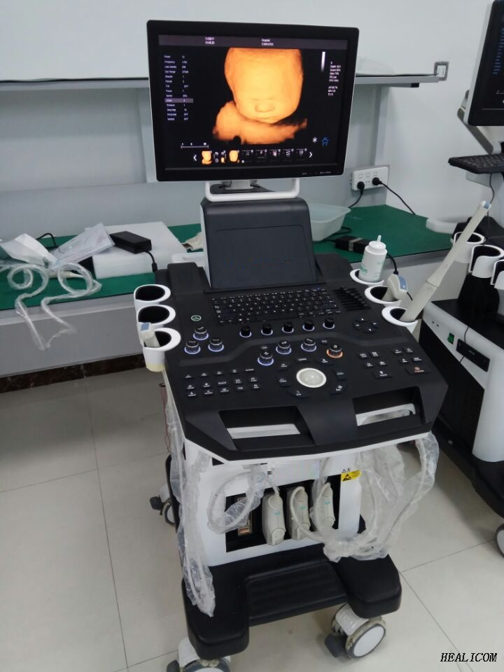 Équipement médical HUC-600P Chariot numérique complet type 4D Scanner à ultrasons Doppler couleur