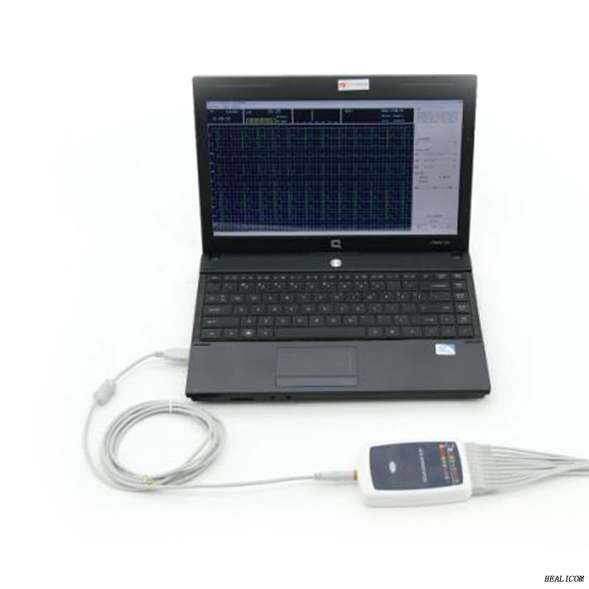 La station de travail portative d'ECG d'ECG de TLC8000G 12 mène des données d'ECG avec Windows